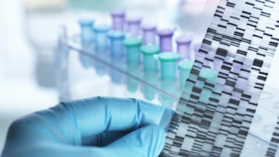 Researchers hope the Emirati Genome Project will lead to big developments in personalised medicine. Getty Images